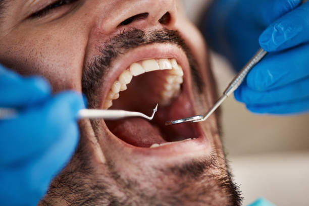Best Emergency Gum Pain Relief  in Morgantown, KY